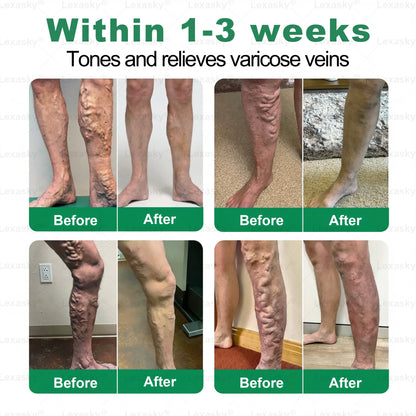 🇺🇸👨‍⚕️✅✅𝐋𝐞𝐱𝐚𝐬𝐤𝐲® 𝐕𝐞𝐢𝐧 𝐓𝐚𝐫𝐠𝐞𝐭 𝐌𝐢𝐜𝐫𝐨𝐧𝐞𝐞𝐝𝐥𝐞 𝐏𝐚𝐭𝐜𝐡⚡Instant Relief, Long-Term Results big sale